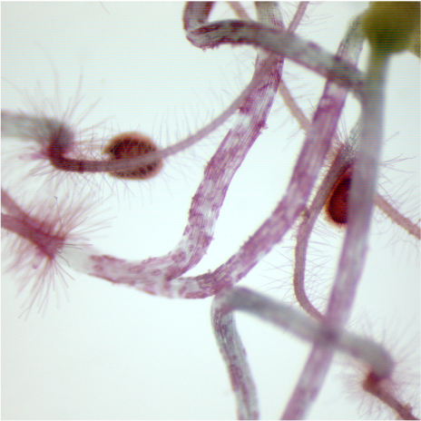突变的单元墙的显微镜照片